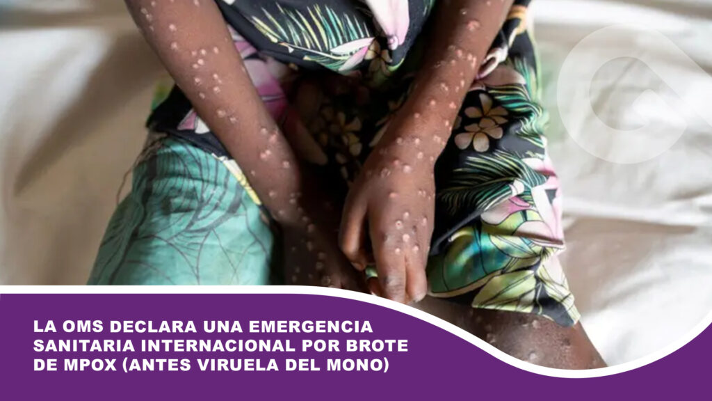 La OMS declara una emergencia sanitaria internacional por brote de mpox (antes viruela del mono)