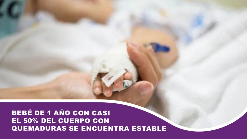 Bebé de 1 año con casi el 50% del cuerpo con quemaduras se encuentra estable