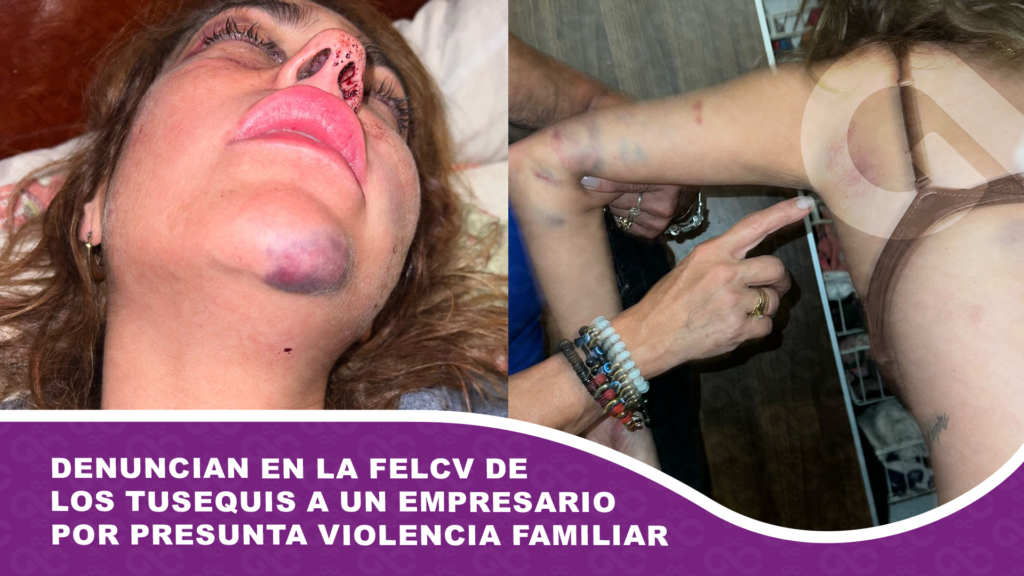 Denuncian en la FELCV de Los Tusequis a un empresario por presunta violencia familiar