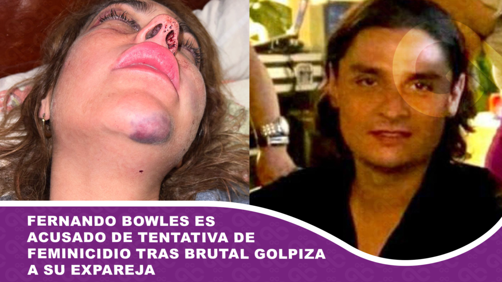 Fernando Bowles es acusado de tentativa de feminicidio tras brutal golpiza a su expareja
