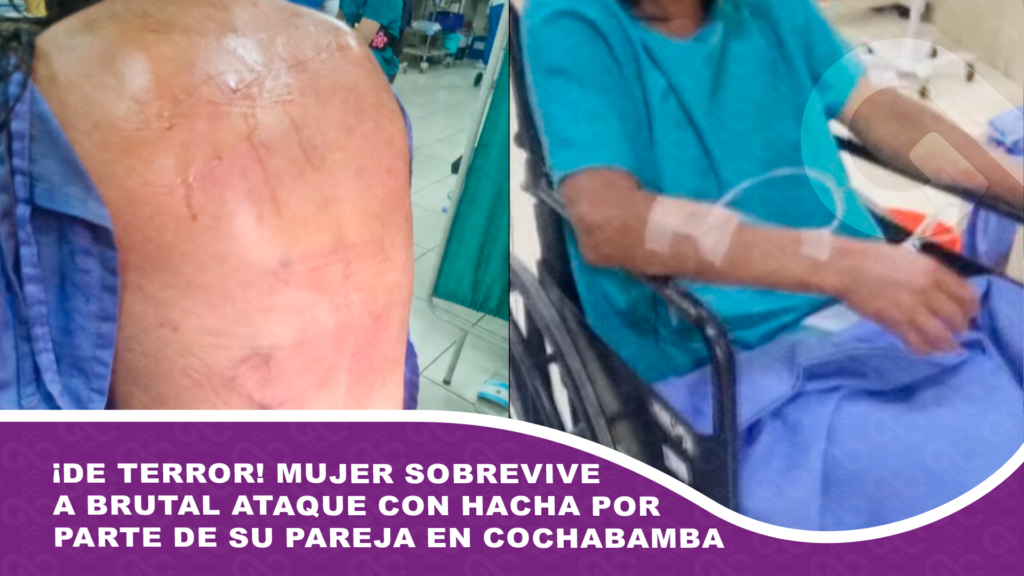 ¡De terror! Mujer sobrevive a brutal ataque con hacha por parte de su pareja en Cochabamba