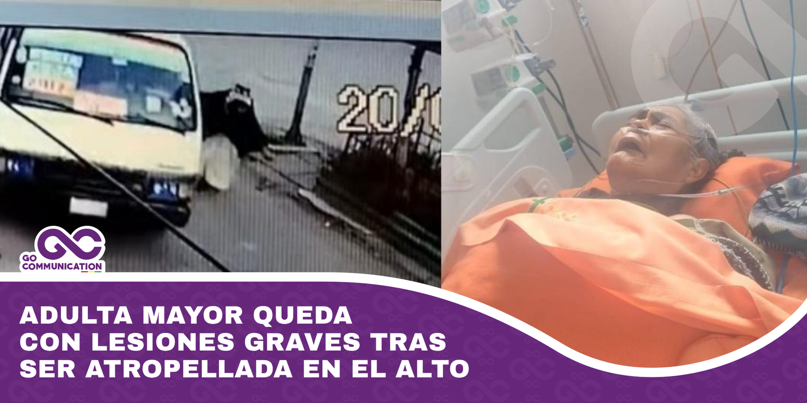 Adulta mayor queda con lesiones graves tras ser atropellada en El Alto