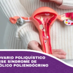 Síndrome de ovario poliquístico pasa a llamarse síndrome de ovario metabólico poliendócrino