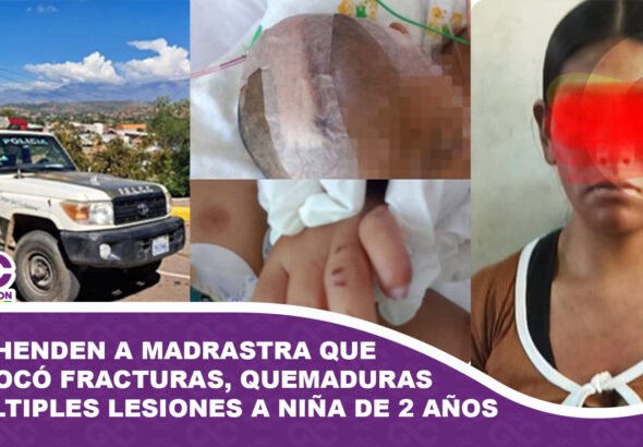 Aprehenden a madrastra que provocó fracturas y quemaduras a niña de 2 años