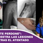 Que Dios te perdone Cerimedo Beller muestra las lesiones sufridas tras el atentado
