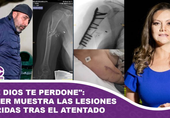 Que Dios te perdone Cerimedo Beller muestra las lesiones sufridas tras el atentado