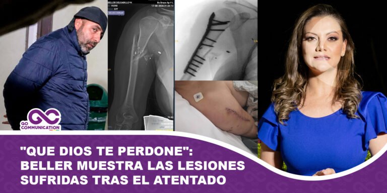 Que Dios te perdone Cerimedo Beller muestra las lesiones sufridas tras el atentado
