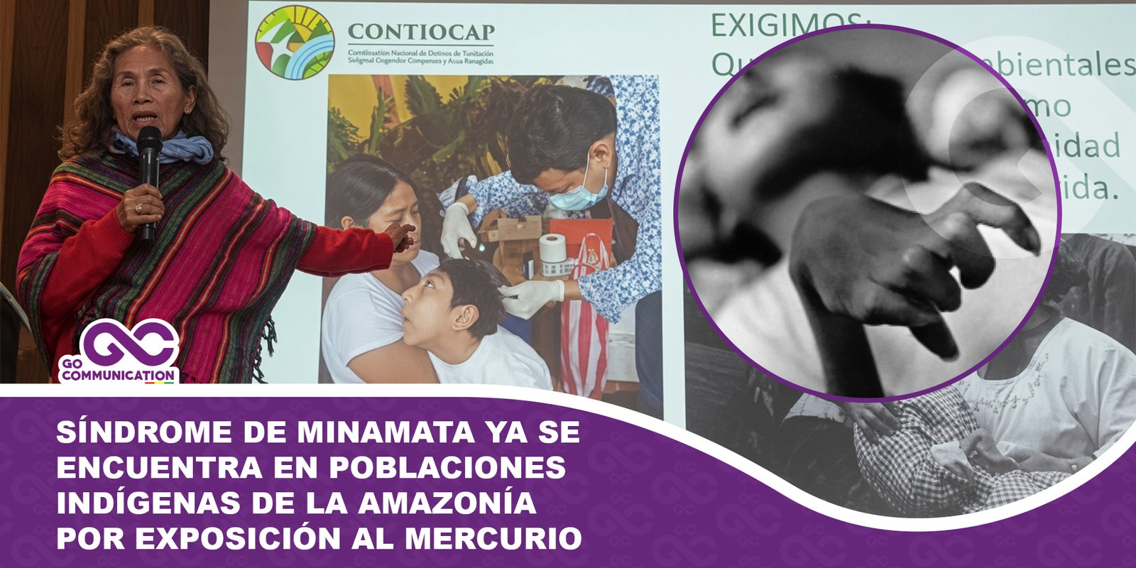 Síndrome de Minamata ya se encuentra en poblaciones indígenas de la Amazonía por exposición al mercurio